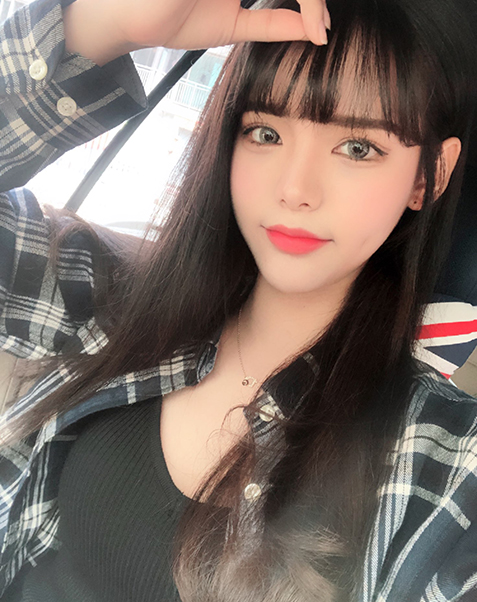 뒤트임+밑트임+턱 지방흡입