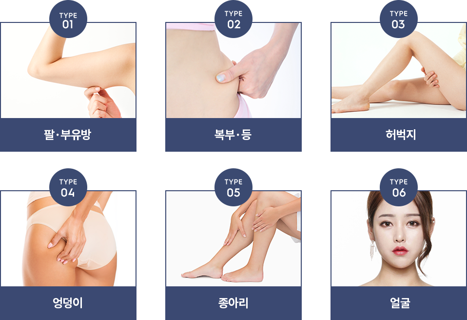 지방흡입수술부위